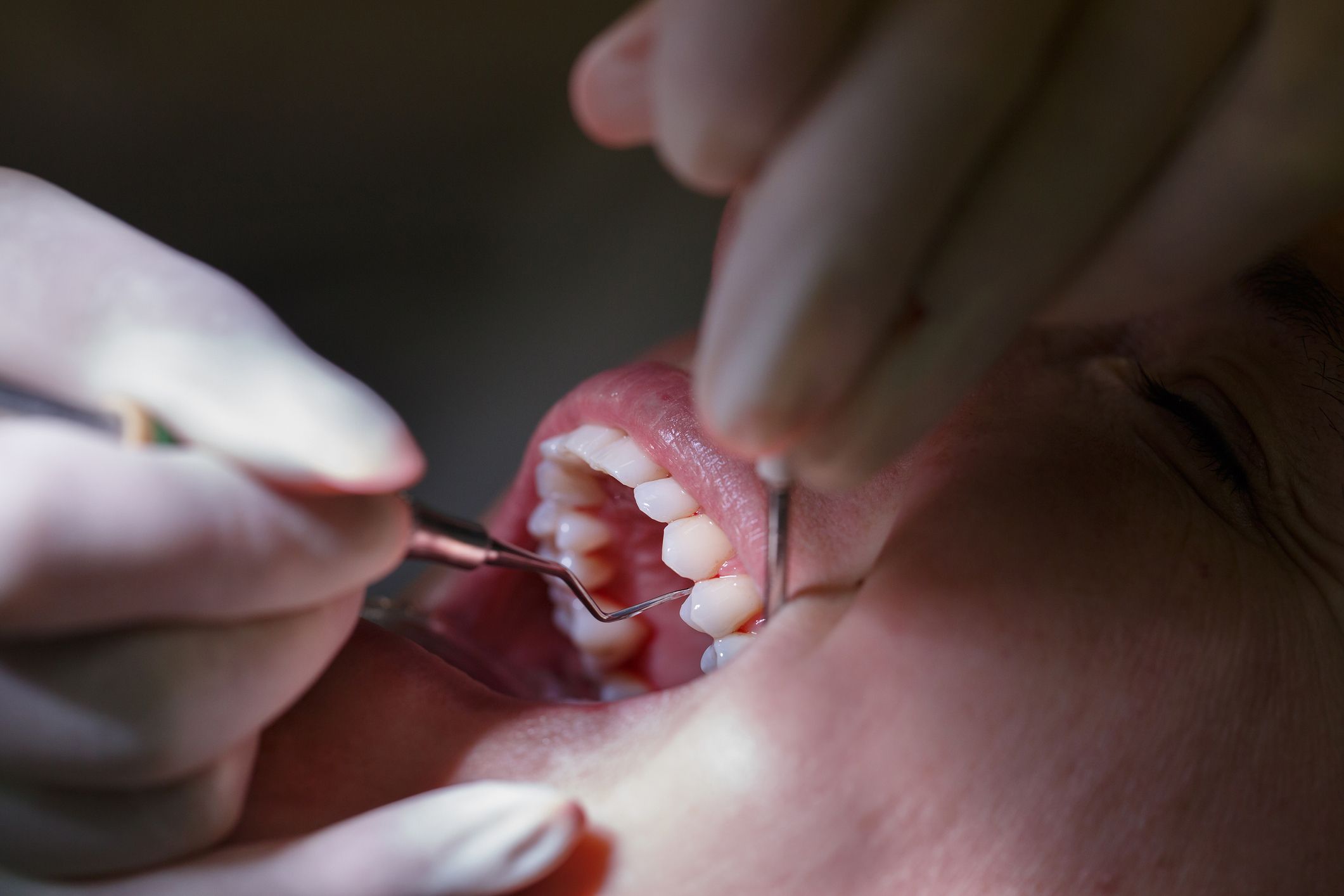 enfermedad periodontal cura