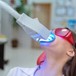 Mitos sobre el blanqueamiento dental