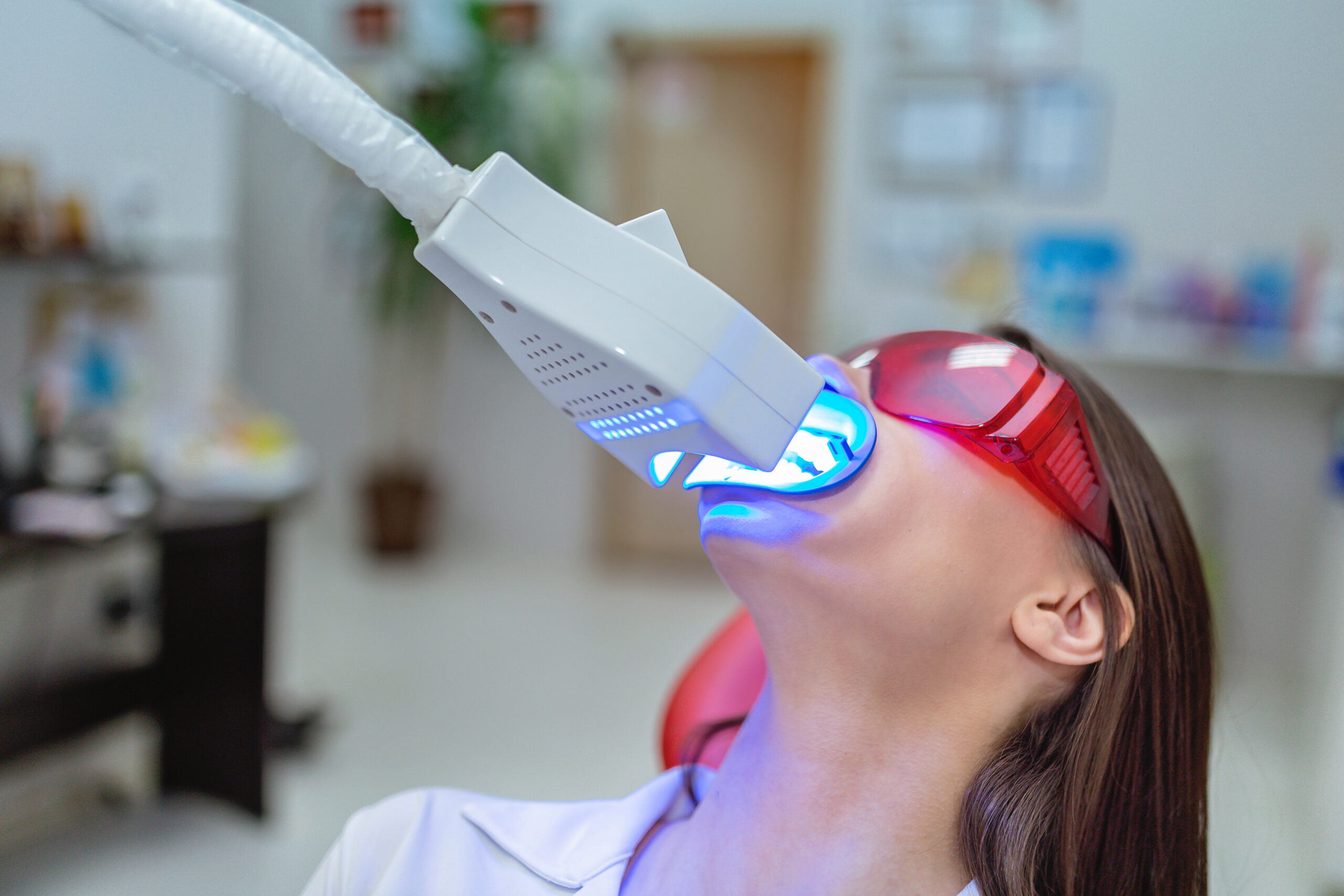 Mitos sobre el blanqueamiento dental