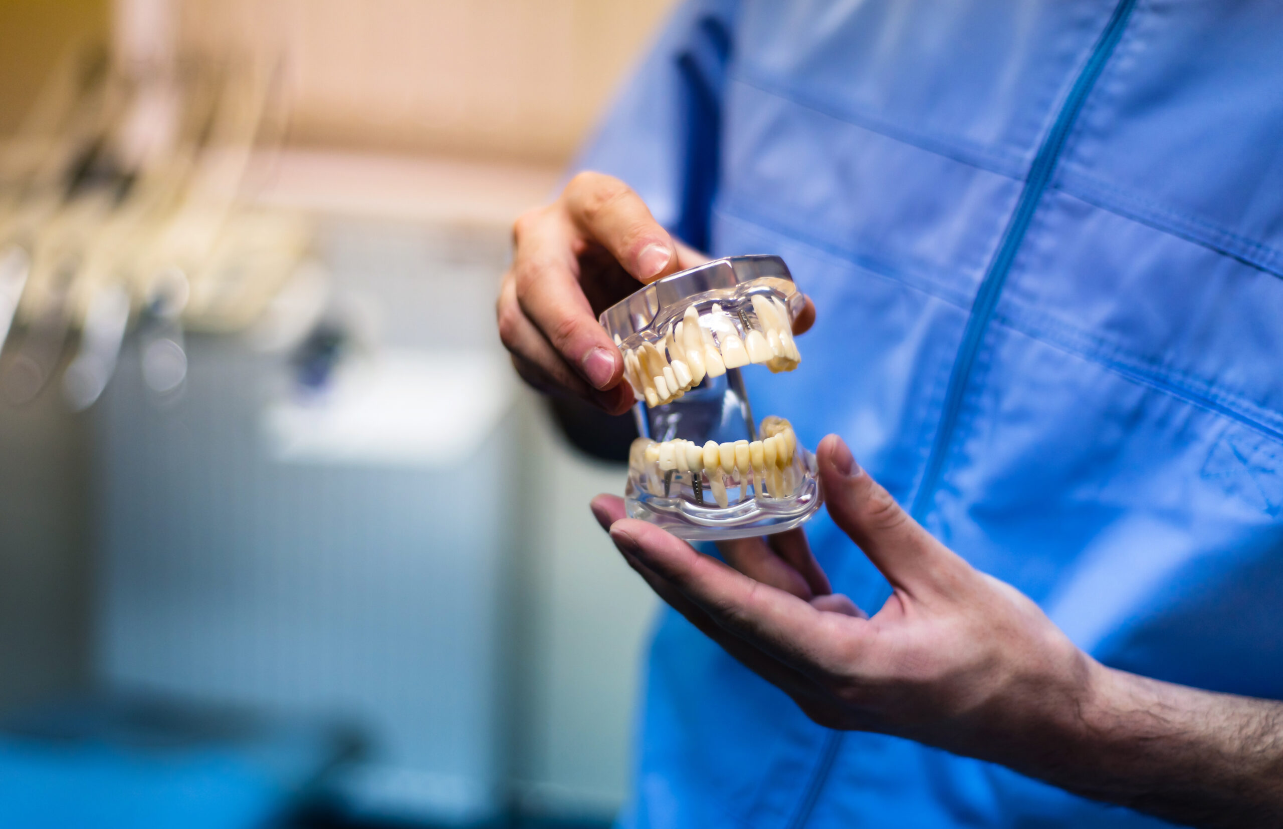 Implantes dentales y bruxismo